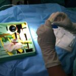 Anesthesia in Enhanced Recovery Programs